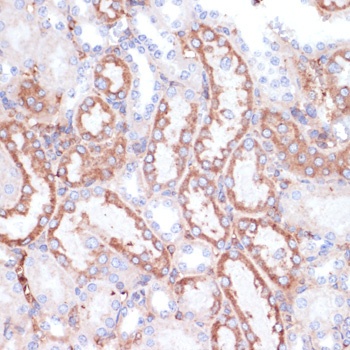 GATM Antibody