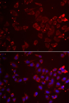 GATM Antibody