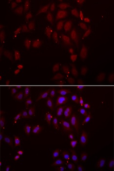 FRZB Antibody