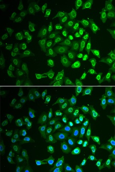 FAH Antibody