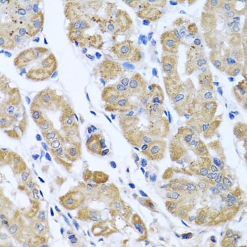 EIF2S3 Antibody