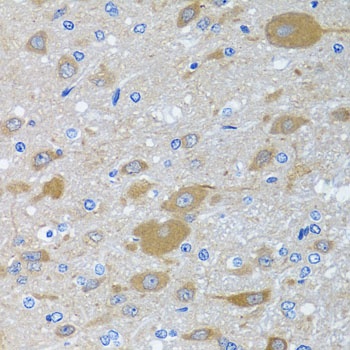 EIF2S3 Antibody