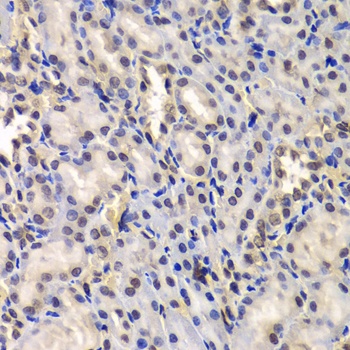 DDX41 Antibody