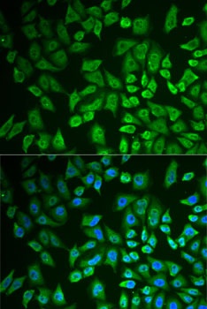 DDX41 Antibody