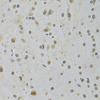 DDX1 Antibody