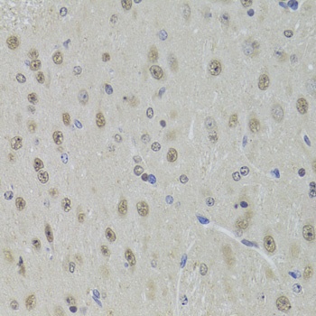 DDX1 Antibody