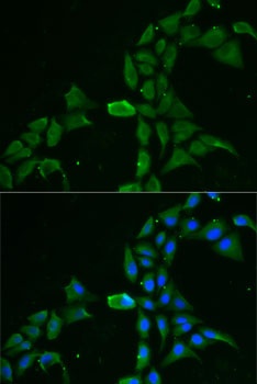 DDX1 Antibody