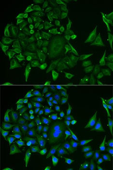 DDX1 Antibody