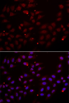 CST2 Antibody