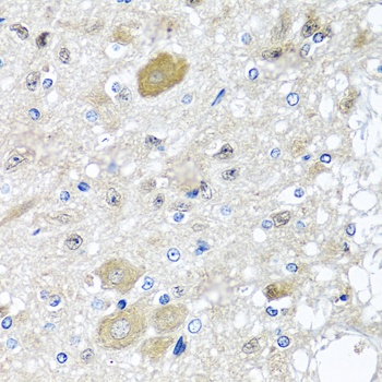 CST1 Antibody