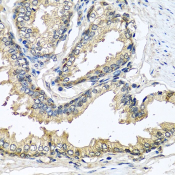 CST1 Antibody