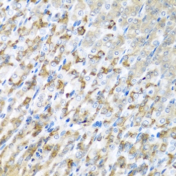 CST1 Antibody