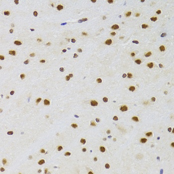 CSRP3 Antibody