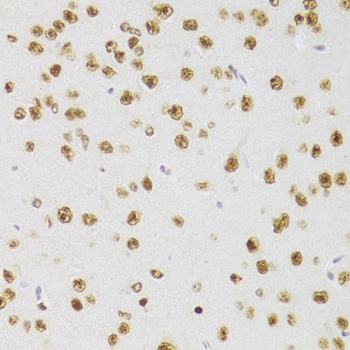 CSRP3 Antibody