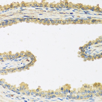 CRHBP Antibody