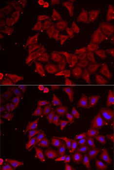 CMPK1 Antibody