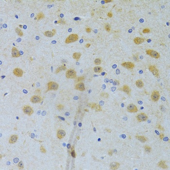 CHIA Antibody