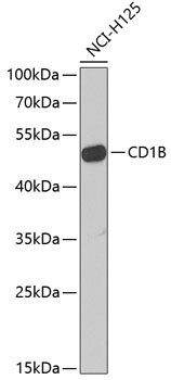 CD1B Antibody