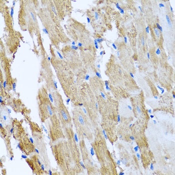 CCM2 Antibody