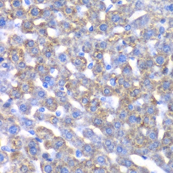 CCBL1 Antibody