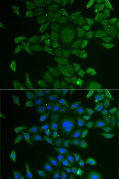 CCBL1 Antibody