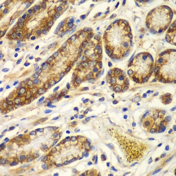 CAPNS1 Antibody