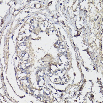 BAP1 Antibody