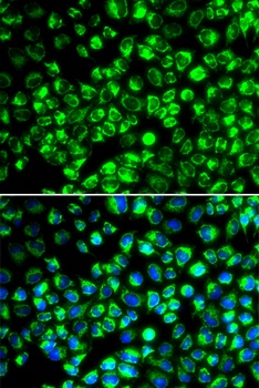 ATP6AP2 Antibody