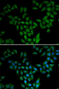 ASF1A Antibody