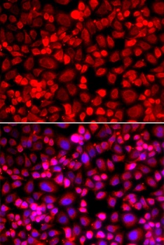 ANLN Antibody