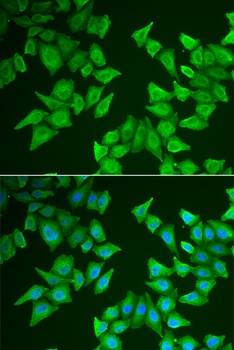 ALAS2 Antibody