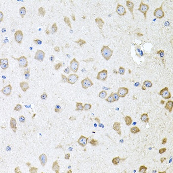 AKAP5 Antibody