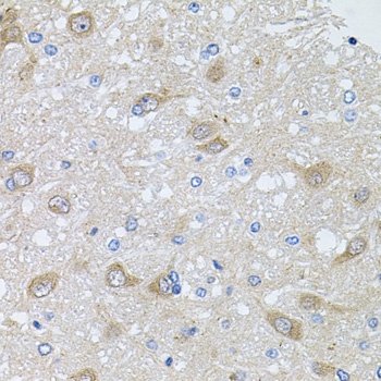 AKAP5 Antibody