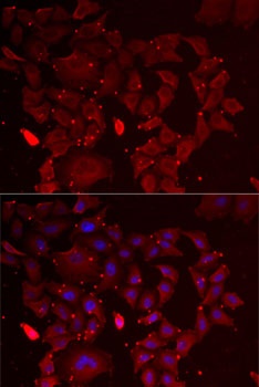 ADSS Antibody