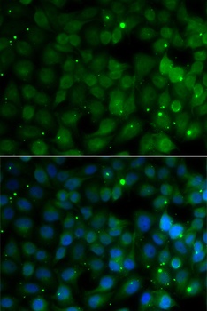 HPD Antibody