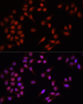 PRDM14 Antibody