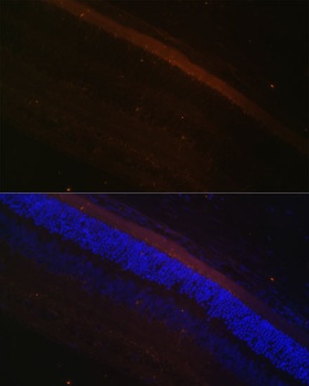 GRK1 Antibody