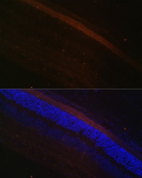 GRK1 Antibody