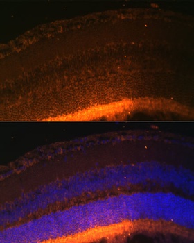 GRK1 Antibody