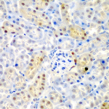 ADAD1 Antibody