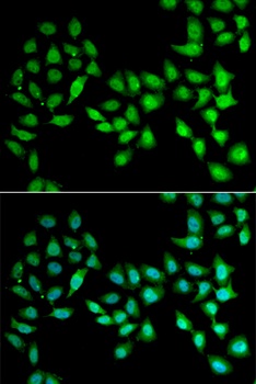 UCN2 Antibody