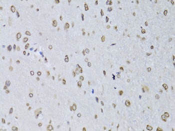 LMNB2 Antibody