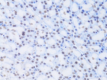 LMNB2 Antibody