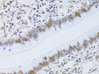 LMNB2 Antibody