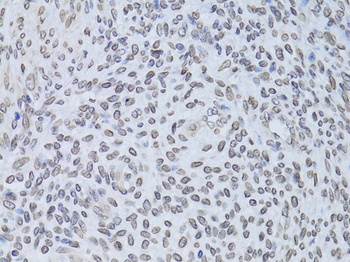 LMNB2 Antibody