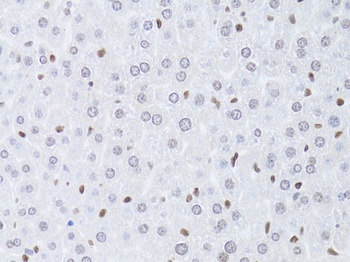 LMNB2 Antibody