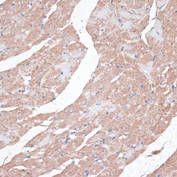 LMNB2 Antibody