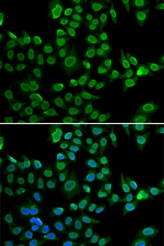 LMNB2 Antibody