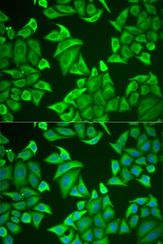 NGB Antibody