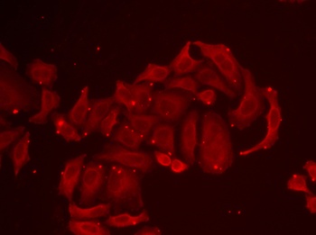 TRPV5 Antibody